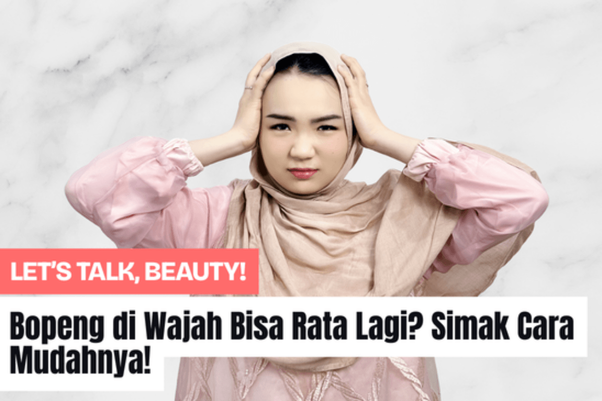 Bopeng di Wajah Bisa Rata Lagi? Simak Cara Mudahnya!
