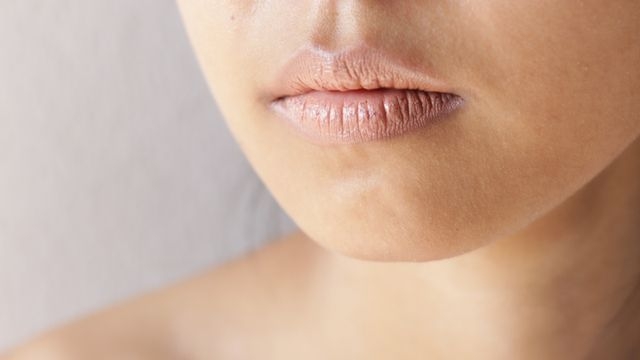 Pigmentasi Bibir Yang Kering dan Pecah-Pecah (Source: post pinterest)